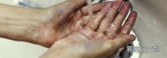 正确戴口罩的六个步骤