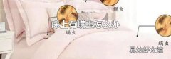 床上有螨虫怎么办