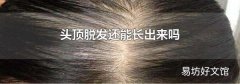 头顶脱发还能长出来吗