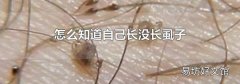 怎么知道自己长没长虱子