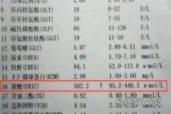 一般尿酸多高才出现痛风 尿酸达到这个数值才算痛风