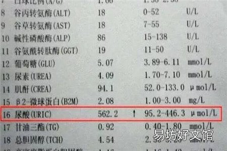 一般尿酸多高才出现痛风 尿酸达到这个数值才算痛风