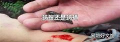 蚂蝗还是蚂蟥