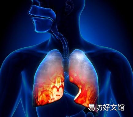 为什么肺癌晚期还不疼 肺癌为什么没有任何不舒服